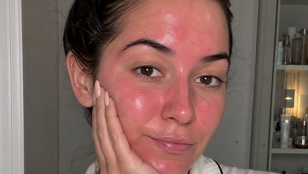 Porque é que a minha cara fica vermelha depois da skincare?