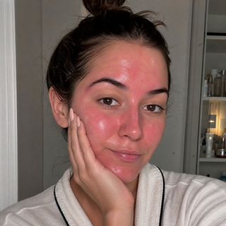 Porque é que a minha cara fica vermelha depois da skincare?