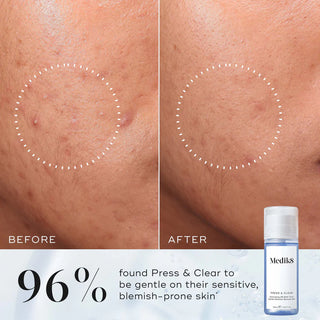 Medik8 Press & Clear Tónico 150mL – Borbulhas & Poros