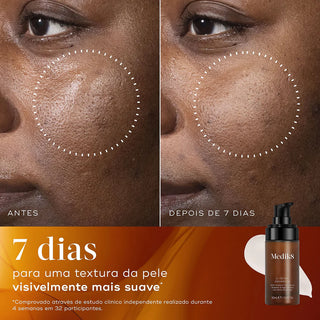 Medik8 C-Tetra Advanced Gel-Sérum 30mL – Luminosidade & Envelhecimento