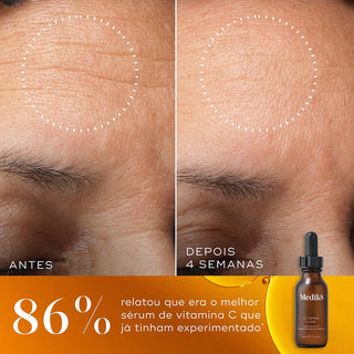 Medik8 C-Tetra Luxe Sérum 30mL – Luminosidade & Envelhecimento