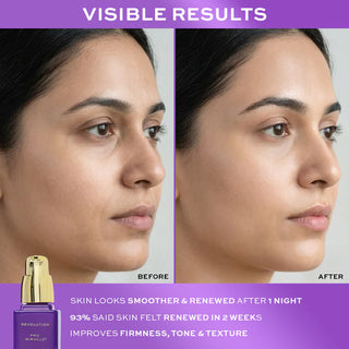 Revolution Pro Miracle Retinoid Refining Serum 30mL – Rugas & Manchas