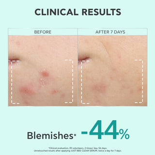 Apivita Just Bee Clear Sérum 30mL – Textura & Marcas de Acne