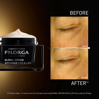 Filorga Global-Repair Advanced Eyes & Lips 15mL – Rugas & Firmeza