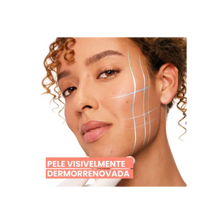 Avène Cleanance Comedomed Sérum Intensivo 30mL – Marcas & Imperfeições